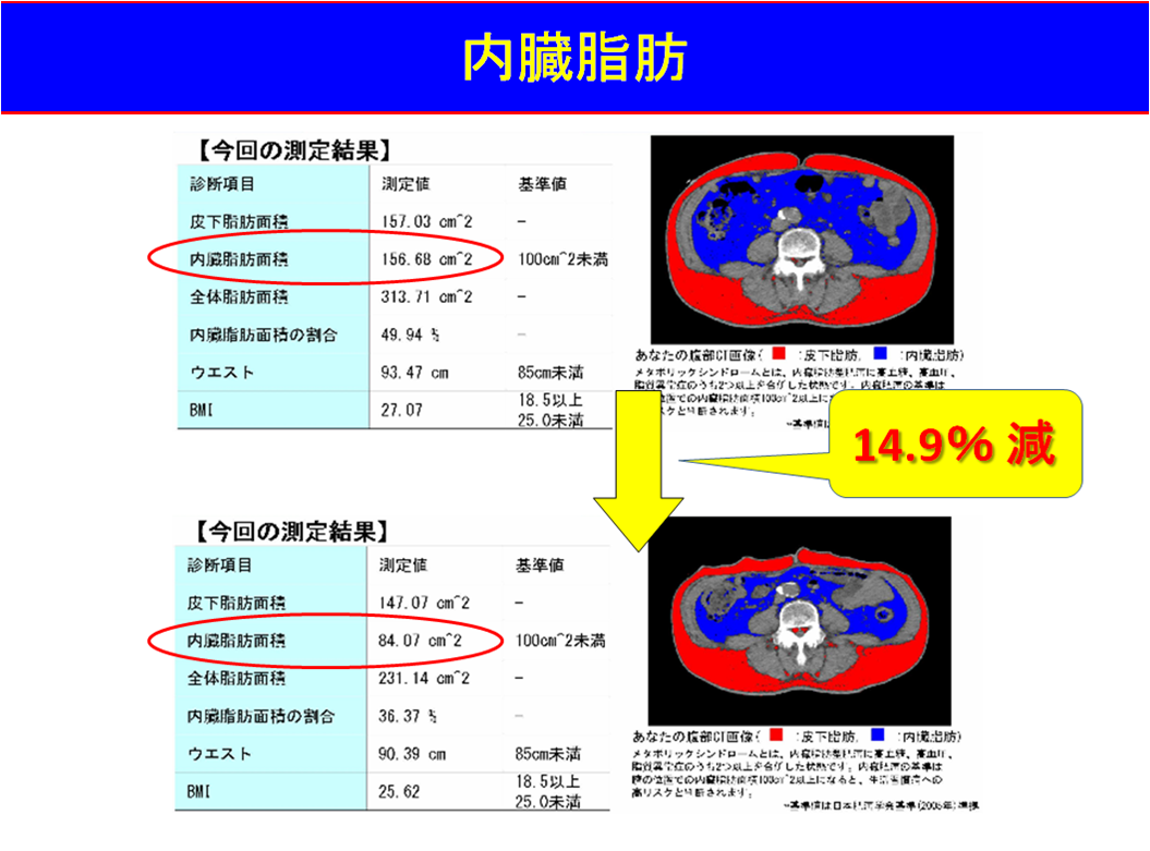 内臓脂肪・心外膜脂肪について