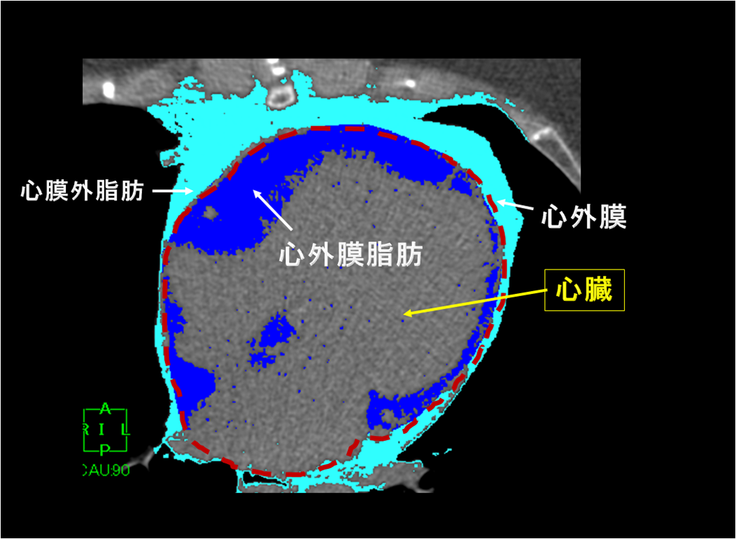 内臓脂肪・心外膜脂肪について